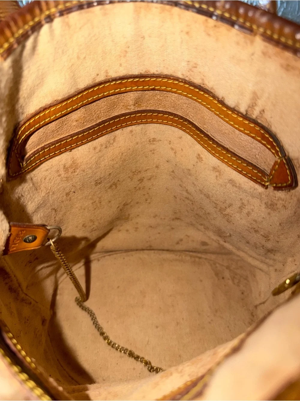 Louis Vuitton 16 peeling rich