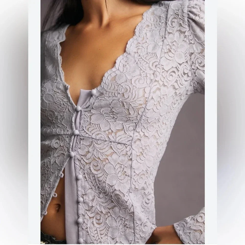 Anthropologie lace button