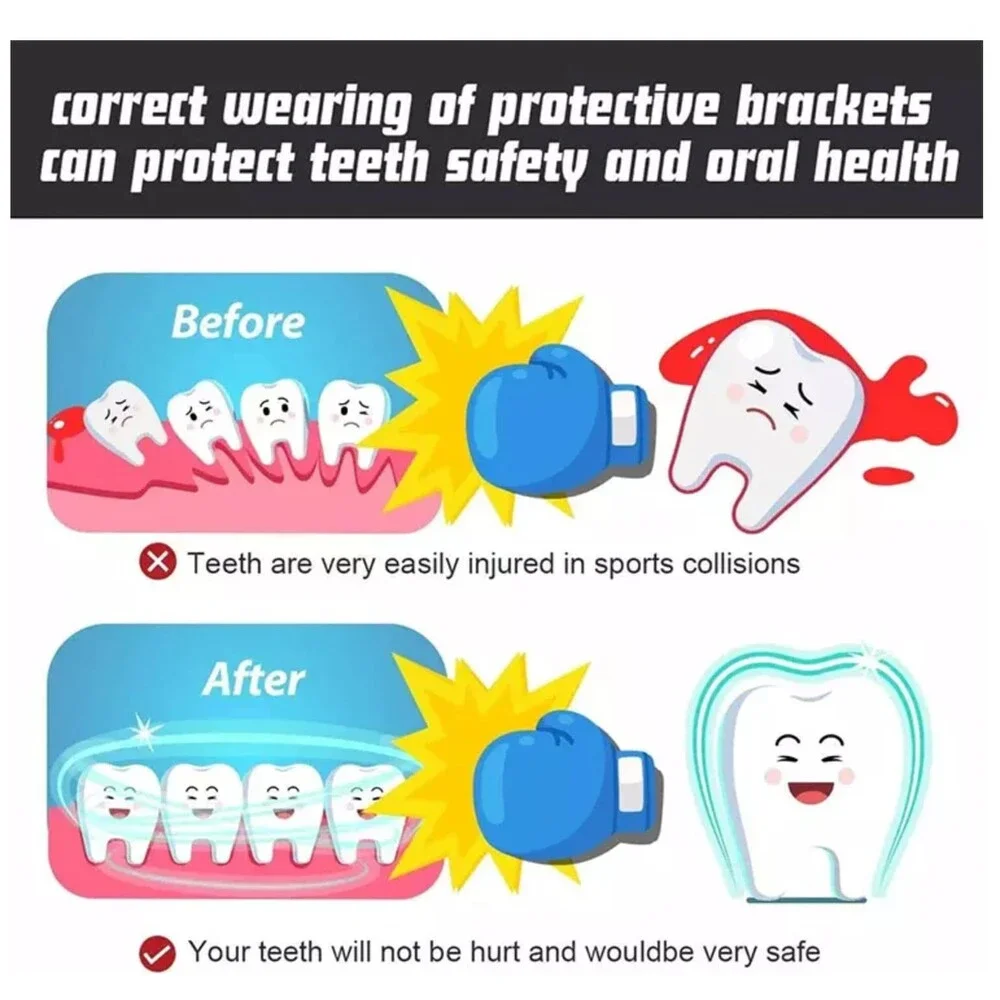 Mouth Guard MMA Sports Mouthguard Teeth Protector Smooth Gum Shield Soft-Slim Mo