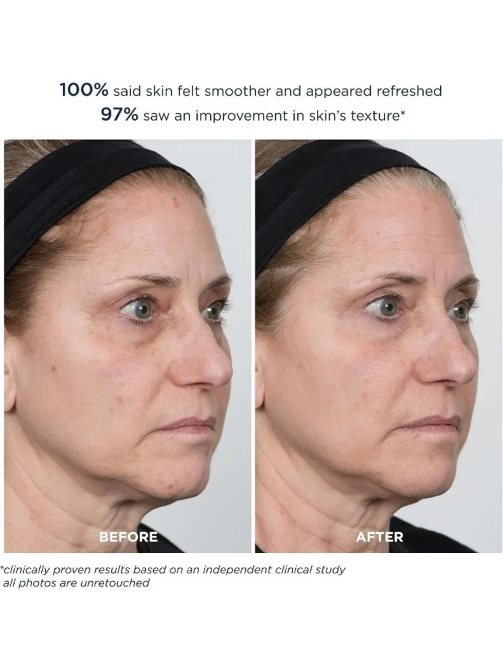 Extra Strength 20% PowerGlow Peel | Intense Overnight Resurfacing Treatment