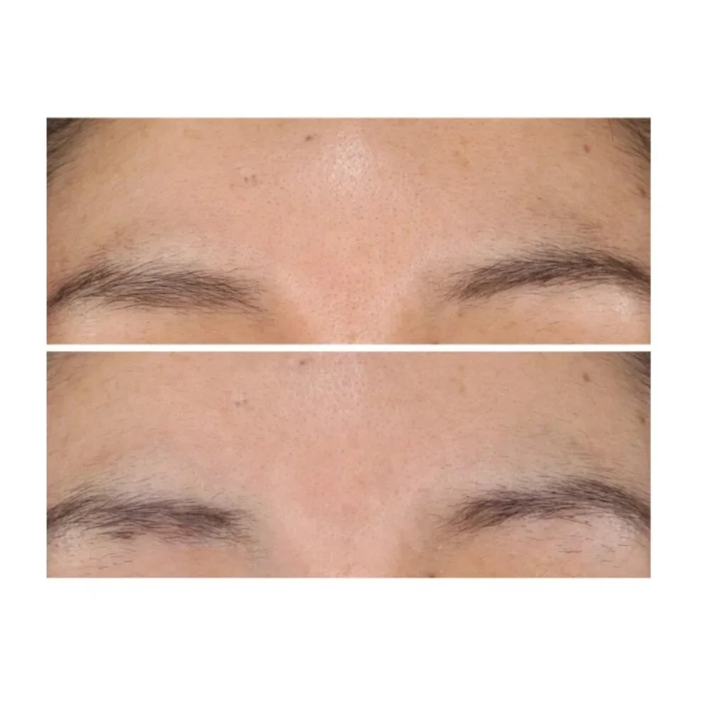 StriVectin perimenopausal appearance