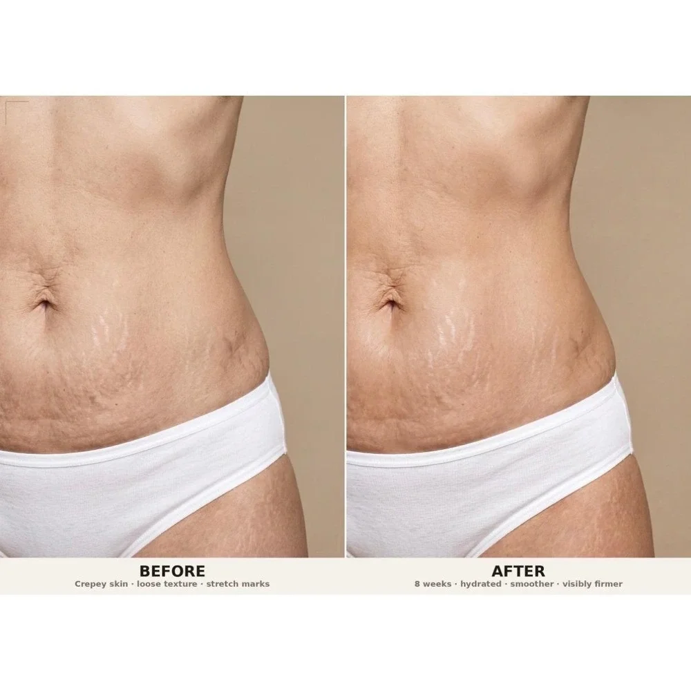 PH Design Organics Firm + Fade‎ Cream 6oz Crepey Skin Stretch Mark Treatment