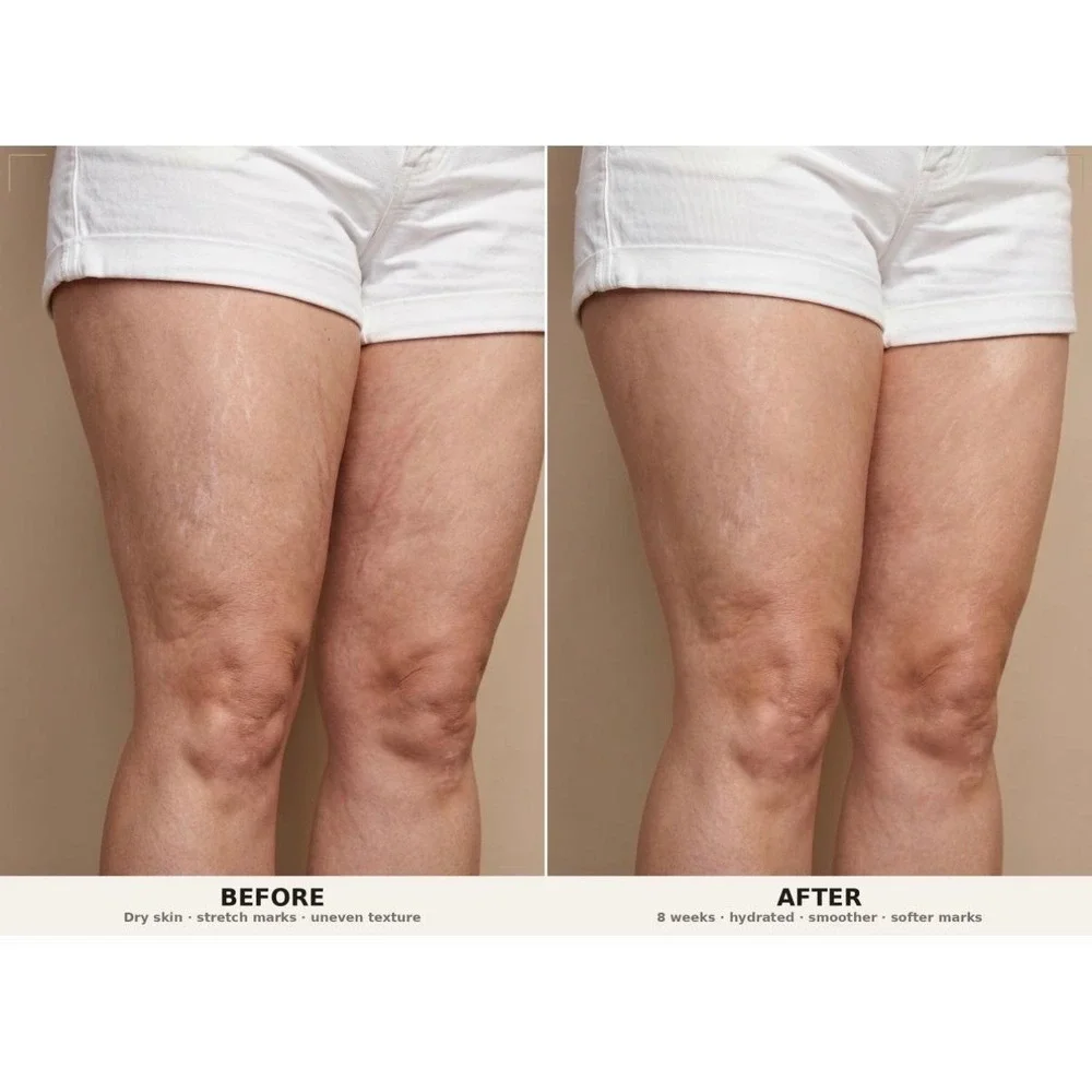 PH Design Organics Firm + Fade‎ Cream 6oz Crepey Skin Stretch Mark Treatment
