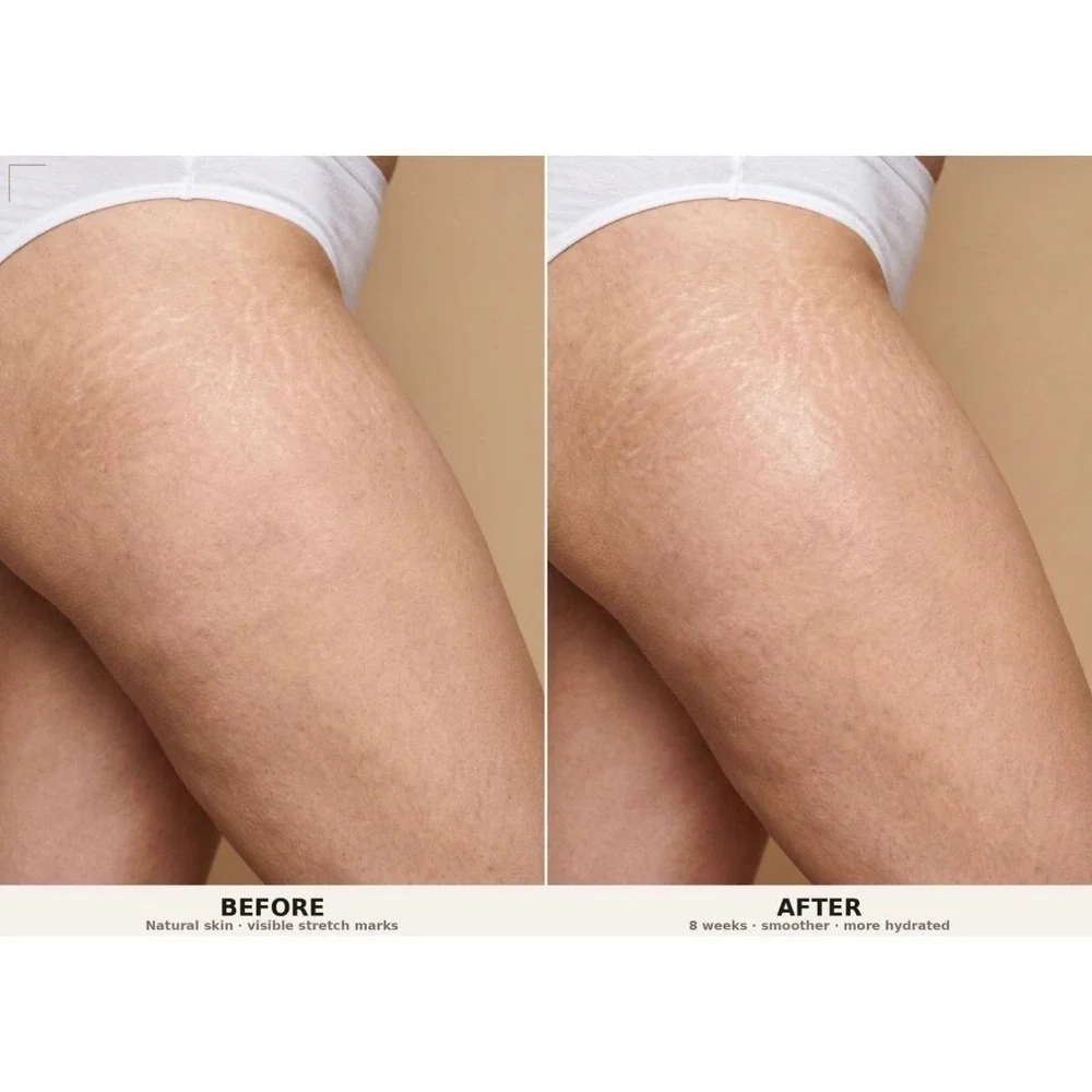 PH Design Organics Firm + Fade‎ Cream 6oz Crepey Skin Stretch Mark Treatment