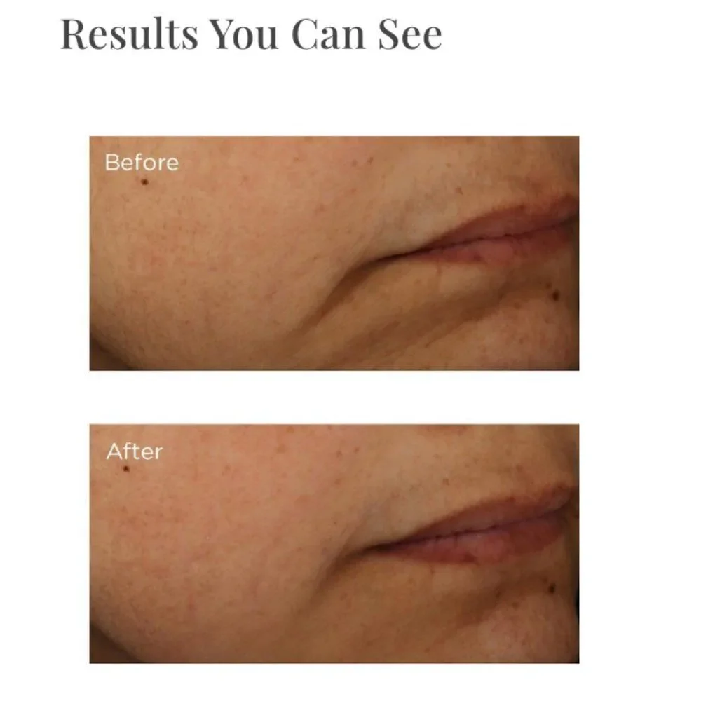 Perricone MD Multi-Action Overnight Intensive Firming Mask