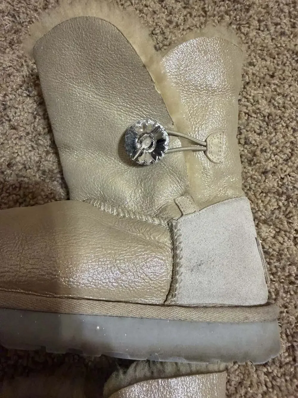 UGG bailey button